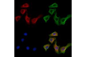 ABIN7094321 and ABIN7098368 staining Hela cells by IF/ICC. (KIF19 抗体  (Internal Region))
