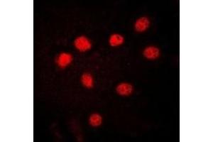 Immunofluorescent analysis of HMGB1 staining in HuvEc cells. (HMGB1 抗体)
