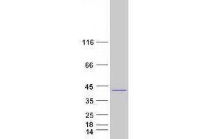 Western Blotting (WB) image for Syntaxin 16 (STX16) (Transcript Variant 2) protein (Myc-DYKDDDDK Tag) (ABIN2733107)
