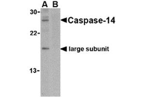 Image no. 1 for anti-Caspase 14, Apoptosis-Related Cysteine Peptidase (CASP14) (C-Term) antibody (ABIN318746) (CASP14 抗体  (C-Term))