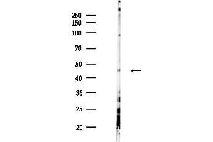 anti-Interferon Regulatory Factor 8 (IRF8) (Internal Region) antibody