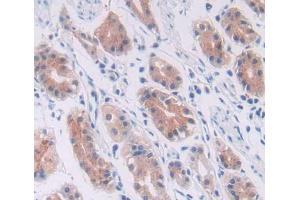 Used in DAB staining on fromalin fixed paraffin- embedded stomach tissue (Cullin 1 抗体  (AA 1-250))