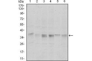 Western blot analysis using PPP1CA mouse mAb against Hela (1), HepG2 (2), MCF-7 (3), Jurkat (4) and A549 (5) cell lysate. (PPP1CA 抗体)