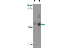 Western blot analysis of MFSD2 in rat lung tissue lysate with MFSD2 polyclonal antibody  at (1) 1 and (2) 2 ug/mL. (MFSD2A 抗体  (C-Term))