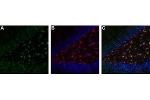 Expression of TrkA in rat brain hippocampal dentate gyrus - Immunohistochemical staining of immersion-fixed, free floating rat brain frozen sections. (TRKA 抗体  (Extracellular))