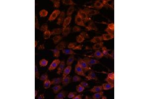 Immunofluorescence analysis of L929 cells using TENM1 antibody (ABIN7270767) at dilution of 1:100. (ODZ1/Teneurin 1 抗体  (AA 350-540))