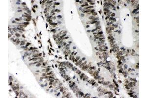 Immunohistochemistry (IHC) image for anti-Class II, Major Histocompatibility Complex, Transactivator (CIITA) (AA 945-1130) antibody (ABIN4886541)