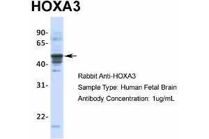 Host:  Rabbit  Target Name:  HOXA3  Sample Type:  Human Fetal Brain  Antibody Dilution:  1. (HOXA3 抗体  (C-Term))