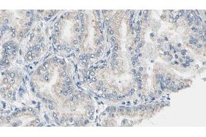 ABIN6276888 at 1/100 staining Human prostate tissue by IHC-P.