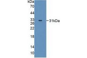 Western blot analysis of recombinant Human MAPK12. (MAPK12 抗体  (AA 27-311))
