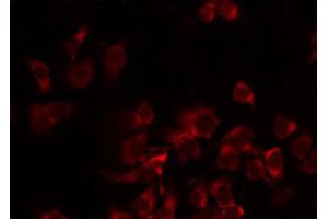 ABIN6274721 staining Hela by IF/ICC. (MRPS35 抗体  (N-Term))