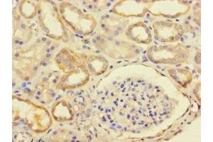 Immunohistochemistry of paraffin-embedded human kidney tissue using ABIN7174731 at dilution of 1:100 (PARP11 抗体  (AA 1-245))