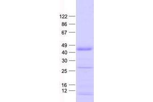 Western Blotting (WB) image for Zinc Finger Protein 684 (ZNF684) protein (His tag) (ABIN2736096)
