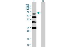 Western Blot analysis of RMI1 expression in transfected 293T cell line by RMI1 MaxPab polyclonal antibody. (RMI1 抗体  (AA 1-470))