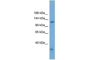 WB Suggested Anti-RFC1 Antibody Titration: 0. (RFC1 抗体  (Middle Region))