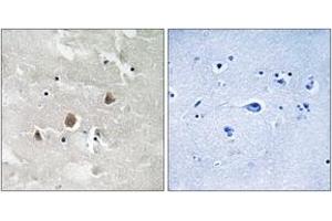 Immunohistochemistry analysis of paraffin-embedded human brain, using MAP3K1 (Phospho-Thr1402) Antibody. (MAP3K1 抗体  (pThr1402))