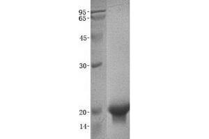 Validation with Western Blot (CST5 Protein (His tag))