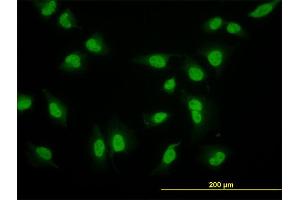 Immunofluorescence of monoclonal antibody to CRSP6 on HeLa cell. (MED17 抗体  (AA 551-651))
