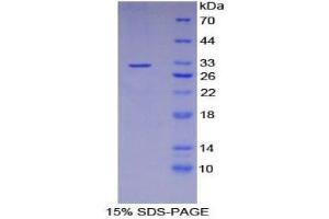 SDS-PAGE (SDS) image for Glutathione S-Transferase omega 1 (GSTO1) (AA 3-240) protein (His tag) (ABIN1877725)