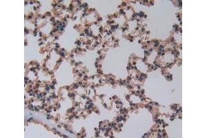 IHC-P analysis of Lung Tissue, with DAB staining.