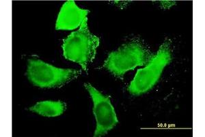 Image no. 3 for anti-phosphoinositide Kinase, FYVE Finger Containing (PIKFYVE) (AA 342-452) antibody (ABIN599337) (PIKFYVE 抗体  (AA 342-452))