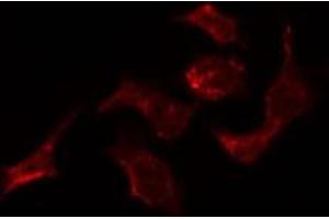 ABIN6278567 staining HepG2 by IF/ICC. (ELAV2/4 抗体)