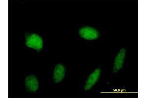 Immunofluorescence (IF) image for anti-Signal Transducer and Activator of Transcription 5A (STAT5A) (AA 1-794) antibody (ABIN950127)