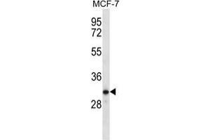 TESSP1 Antibody (Center) western blot analysis in MCF-7 cell line lysates (35 µg/lane). (TESSP1 抗体  (Middle Region))