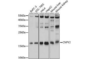 Western blot analysis of extracts of various cell lines, using CNPY2 antibody. (CNPY2/MSAP 抗体)
