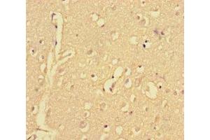 Immunohistochemistry of paraffin-embedded human brain tissue using ABIN7148515 at dilution of 1:100 (Copine II 抗体  (AA 1-300))