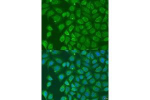 Immunofluorescence analysis of U2OS cells using HOXD10 antibody (ABIN2736912) at dilution of 1:100. (HOXD10 抗体)