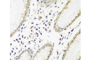 Immunohistochemistry of paraffin-embedded Human stomach using PYCR1 Polyclonal Antibody at dilution of 1:200 (40x lens). (PYCR1 抗体)