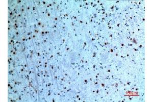 Immunohistochemistry (IHC) image for anti-Keratin 14 (KRT14) (C-Term) antibody (ABIN3187714)