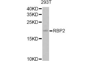 Western blot analysis of extracts of 293T cells, using RBP2 Antibody. (RBP2 抗体)