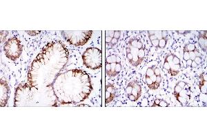 Immunohistochemical analysis of paraffin-embedded stomach tissues (left) and colon tissues (right) using CA9 mouse mAb with DAB staining. (CA9 抗体)