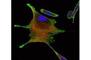 Immunofluorescence analysis of Eca109 cells using BMPR2 mouse mAb (green). (BMPR2 抗体)