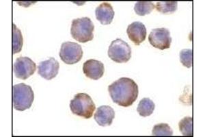 Immunocytochemistry of TACE in HeLa cells with TACE Antibody AP30854PU-N at 10 µg/ml. (ADAM17 抗体  (C-Term))