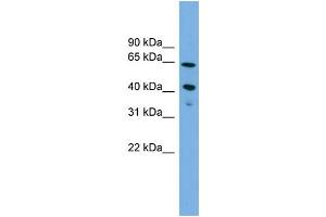 WB Suggested Anti-ATP8B2  Antibody Titration: 0. (ATP8B2 抗体  (N-Term))