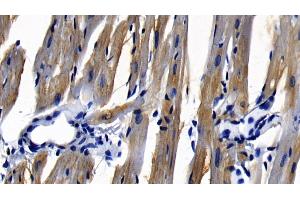 Immunohistochemistry (IHC) image for anti-Myeloid Differentiation Primary Response Gene (88) (MYD88) (AA 32-265) antibody (ABIN7433990)