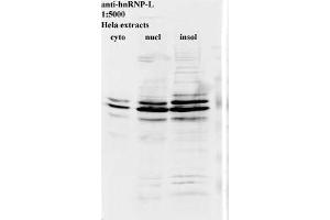 Western blot for anti-hnRNP-L on HeLa cell extracts (HNRNPL 抗体)