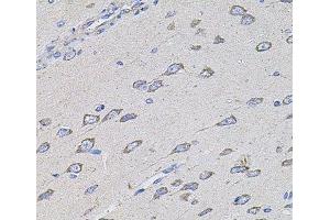 Immunohistochemistry of paraffin-embedded Rat brain using TMC1 Polyclonal Antibody at dilution of 1:100 (40x lens). (TMC1 抗体)