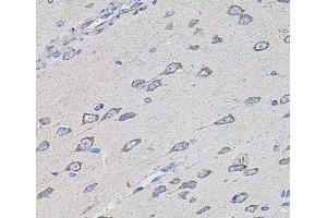 Immunohistochemistry of paraffin-embedded Rat brain using TMC1 Polyclonal Antibody at dilution of 1:100 (40x lens).