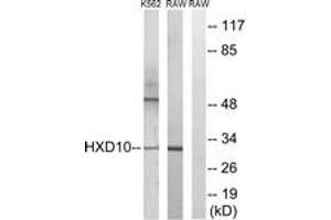 Western blot analysis of extracts from K562/RAW264. (HOXD10 抗体  (AA 291-340))