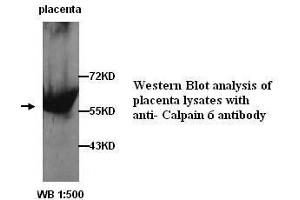 Image no. 1 for anti-Calpain 6 (CAPN6) (C-Term) antibody (ABIN790874) (Calpain 6 抗体  (C-Term))