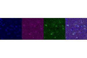 Immunohistochemistry (IHC) image for anti-Glutamate-Ammonia Ligase (GLUL) antibody (ABIN7456060) (GLUL 抗体)