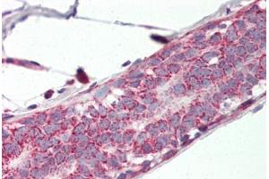 Human Breast (formalin-fixed, paraffin-embedded) stained with PHB2 antibody ABIN337044 at 5 ug/ml followed by biotinylated goat anti-rabbit IgG secondary antibody ABIN481713, alkaline phosphatase-streptavidin and chromogen. (Prohibitin 2 抗体  (AA 88-299))