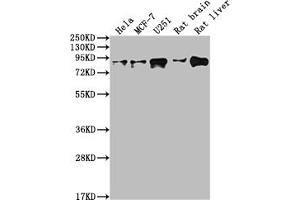 Western Blot Positive WB detected in: Hela whole cell lysate, MCF-7 whole cell lysate, U251 whole cell lysate, Rat brain tissue, Rat liver tissue All lanes: VCP antibody at 1:2000 Secondary Goat polyclonal to rabbit IgG at 1/50000 dilution Predicted band size: 90 kDa Observed band size: 90 kDa (Recombinant VCP 抗体)