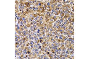 Immunohistochemistry of paraffin-embedded mouse cancer using UBE2R2 antibody. (UBE2R2 抗体  (AA 1-238))