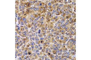 Immunohistochemistry of paraffin-embedded mouse cancer using UBE2R2 antibody.