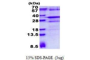 Figure annotation denotes ug of protein loaded and % gel used. (RSG1 蛋白)